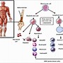 Image result for Types of Leukemia