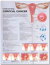 Image result for Cervical Cancer Anatomy