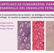 Image result for csrtilaginoso