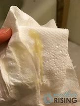 Image result for What Does Mucus Plug Look Like