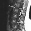 Image result for T2 Lumbar Spine MRI