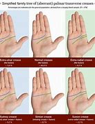 Image result for Reset Hand