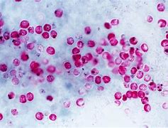 Image result for cryptosporidium_parvum