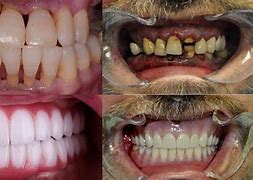 Image result for Messed Up Teeth
