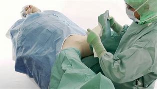 Image result for Lithotomy Position Draping