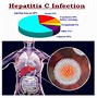 Image result for Hepatitis C