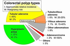 Image result for Colon Polyp Size and Cancer Risk