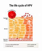 Image result for Human Papillomavirus How Do You Get It