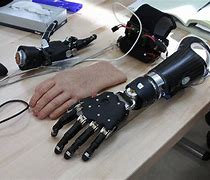 Image result for Robot Arm On Human
