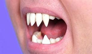 Image result for Sharp Teeth Pictures