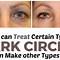 Image result for Under Eye Dark Circle And Puffiness Treatment Roller