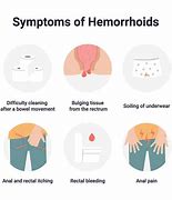 Image result for Hemorrhoids