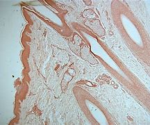 Image result for Human Skin Black and White