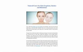 Image result for Crusty Skin Eruptions