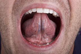 Image result for Small Tongue