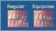 Image result for Equipoise Clasp