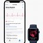 Image result for Apple Watch That Checks EKG