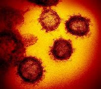 Image result for Covid Virus Under Microscope