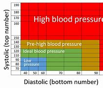Image result for Blood Pressure Band Women