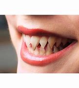 Image result for White Sharp Teeth