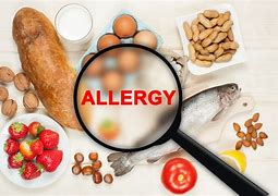 Image result for Food Allergy