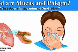 Image result for Asthma Phlegm Color