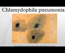 Image result for chlamydophila_pneumoniae