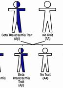 Image result for Sickle Cell Trait Genetics