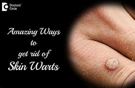Image result for Stages of Wart Removal