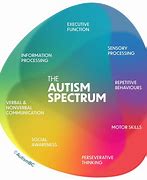 Image result for Autism Spectrum Disorder Brain