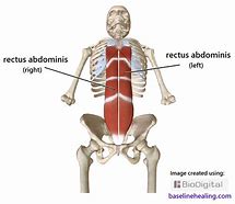 Image result for Left Rectus Abdominis Muscle