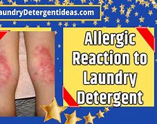 Image result for Pictures of Laundry Detergent Ankle Rash