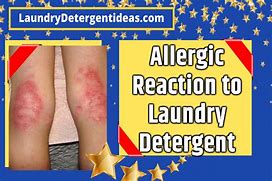 Image result for Allergic Reaction to Detergent