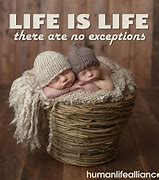 Image result for Pro-Life Baby Images