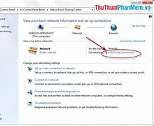 Image result for Connect Local Area Connection