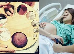 Image result for Woman 10 Cm Dilated