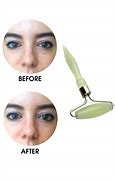 Image result for Jade Roller Before and After