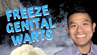 Image result for Cryotherapy for Genital Warts