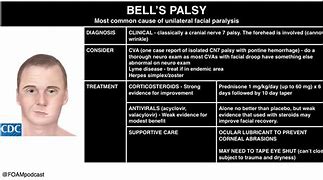 Image result for Bell's Palsy Scale