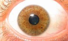 Image result for What Is a Mole On the Retina
