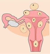 Image result for 10 Cm Uterine Fibroid