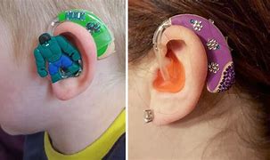 Image result for Children's Hearing Aids
