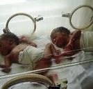 Image result for Identical Triplets Babies