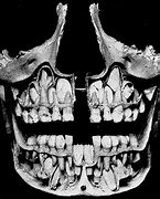 Image result for Baby Teeth Coming