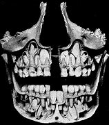 Image result for Old Human Skull Teeth
