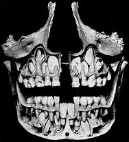 Image result for Teeth Jawbone