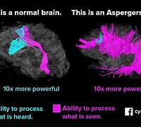 Image result for I Have Asperger's