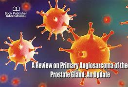 Image result for Angiosarcoma