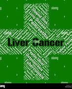 Image result for Large Liver Tumors
