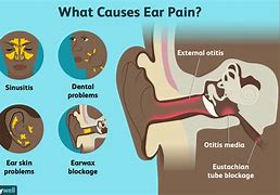 Image result for Sharp Pain Behind Ear